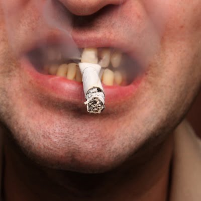 Can Smokers Get Dental Implant?