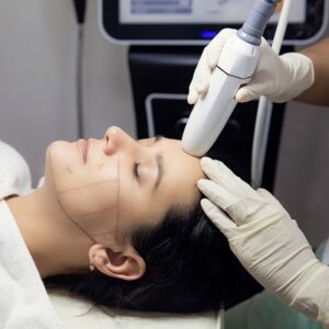 HIFU Treatment Change Your Face Shape