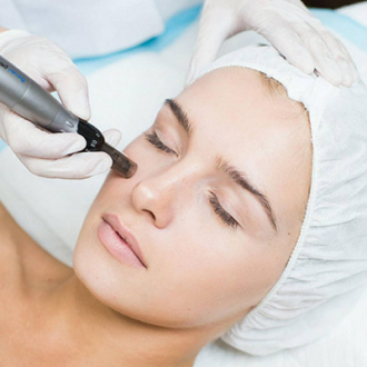 How Much Does Virtue RF Micro-needling Cost in Islamabad?