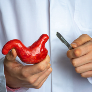Stomach Grow After Bariatric Surgery in Islamabad