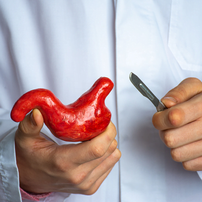Smoking after Bariatric Surgery | weight loss treatment