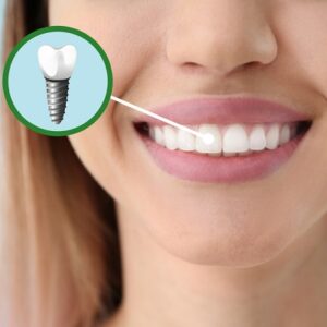 Dental Implants with Severe Bone Loss
