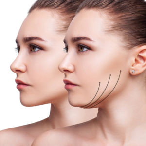 Treating Double Chin Removal in Islamabad