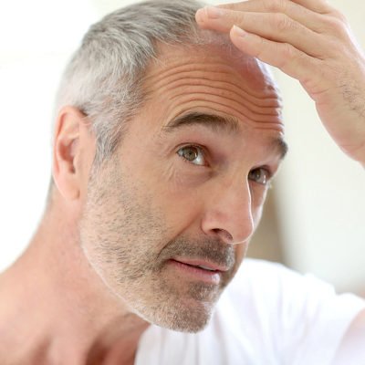 How Radiation Can Cause Hair Loss