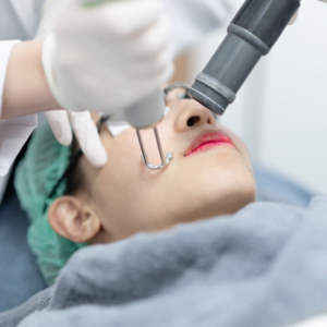 Can I Do Pico Laser Treatment Every 2 Weeks?