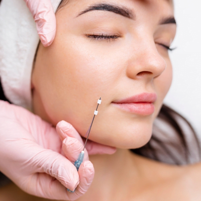 Targeted Area for a Thread Lift | Thread lift in Islamabad