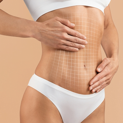 How Many Pant Sizes Can I Lost with Tummy Tuck?