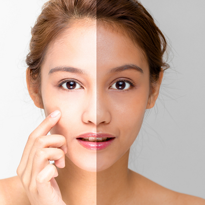 Which treatment is best for skin whitening & tightening?