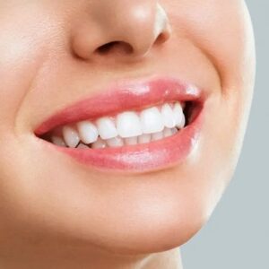 Can Fillings Close Gaps in Teeth?