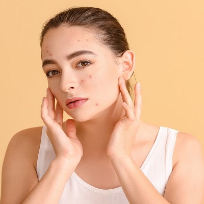Can acne nodules be removed?