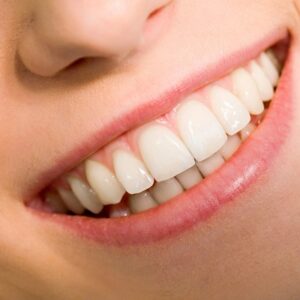 Diamond Crown for Teeth in Islamabad