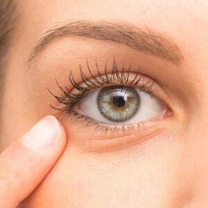 Do eye bags return after surgery?