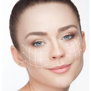 How Long Is Thread Lift Recovery Time?