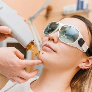 How long does a mole removal take to heal?