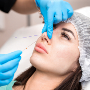 How long does a nonsurgical nose job last?