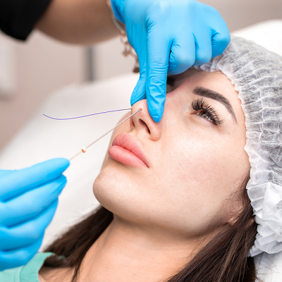How long does a nonsurgical nose job last in Islamabad?