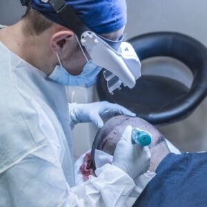 Can Hair Transplant Cure Genetic Baldness?