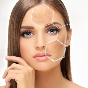 Can Laser Hair Removal in Islamabad Cause Hyperpigmentation?