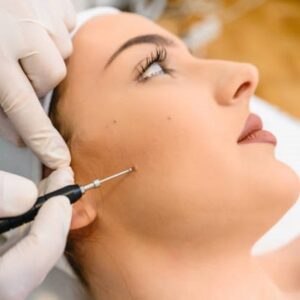 Can a Mole Grow Back After Laser Removal?