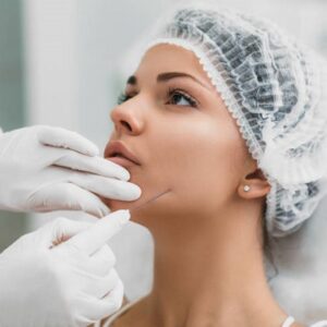 Can I Exercise After Thread Lift?