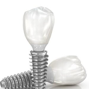 Can I Use Toothpaste After Dental Implant?