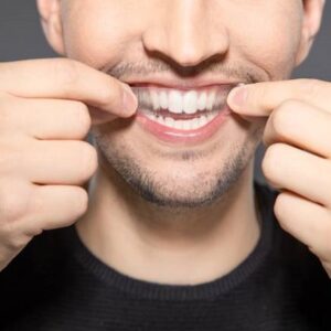 Can Smokers Get Their Teeth Whitened?
