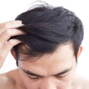 Do Hair Wigs for Men Need A Shampoo?