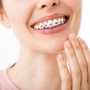 Do braces move your teeth every day?