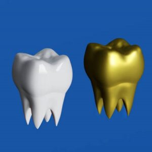 Do teeth caps stain?