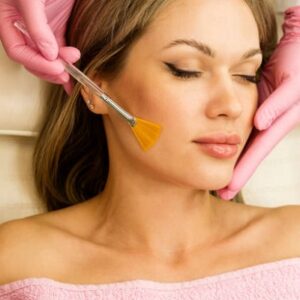 Sessions of Chemical Peels Are Required