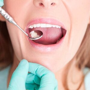 Dental Filling in Islamabad a Painful Procedure