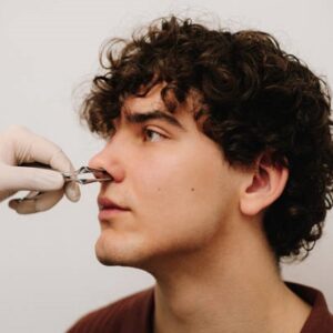 Results Can You Expect from Rhinoplasty in Islamabad