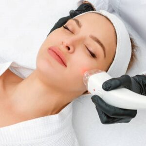 Black dots after laser hair removal