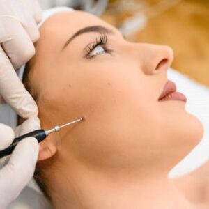 Dermatologists Can Remove Skin Tags