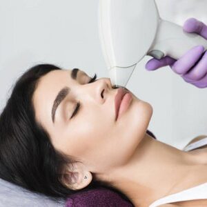 Power level is needed for laser hair removal