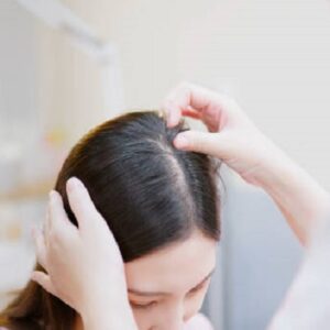 Why is My Wife Losing So Much Hair?