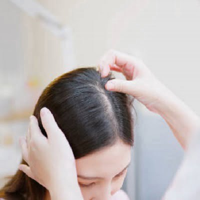 Why is My Wife Losing So Much Hair?