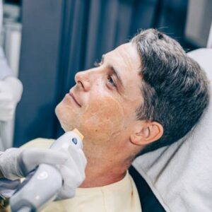 Pigmentation getting darker after pico laser