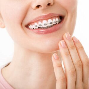 Will My Teeth Move 10 Years After Braces?