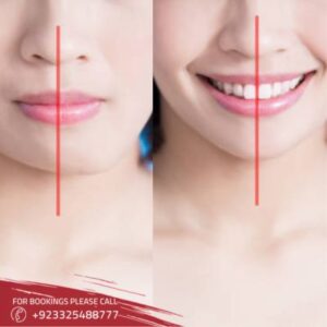 images of Jaw Surgery in islamabad