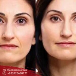 images of stem cell facelift in Islamabad