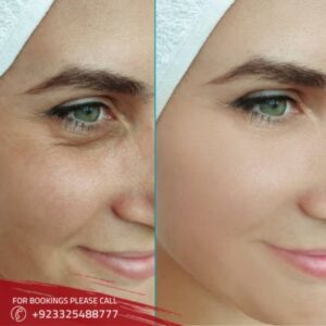 results of magic facelift in Islamabad