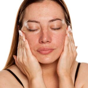 Mistakes to Avoid in Melasma Treatment