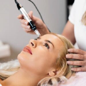 Enhancing your skin health with micro-needling treatment