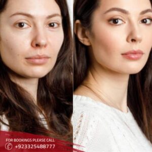 Facial Treatments
