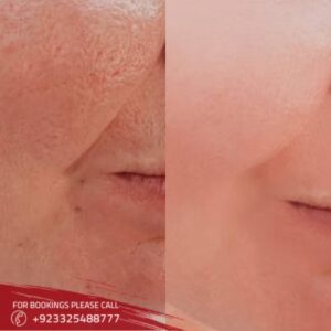 Facial Treatments images