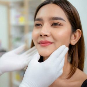How many fillers are needed for cheeks