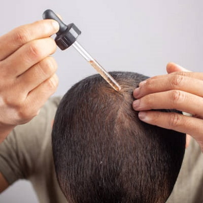 Is There Any Role Of Medicines In Baldness?