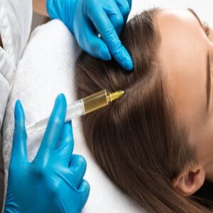 PRP: Natural Approach to Hair Regrowth and Rejuvenation