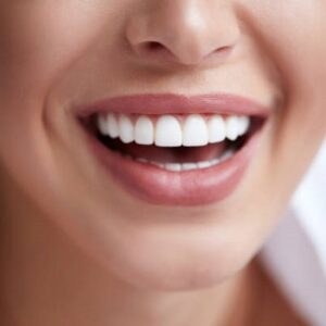 Which teeth whitening is permanent?
